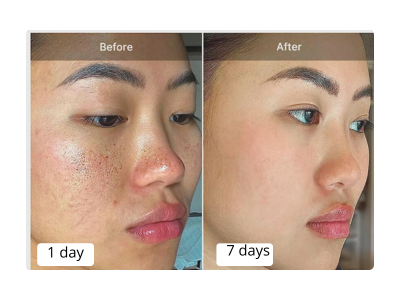 Zero Pore Pad