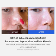 Zero Pore Pad