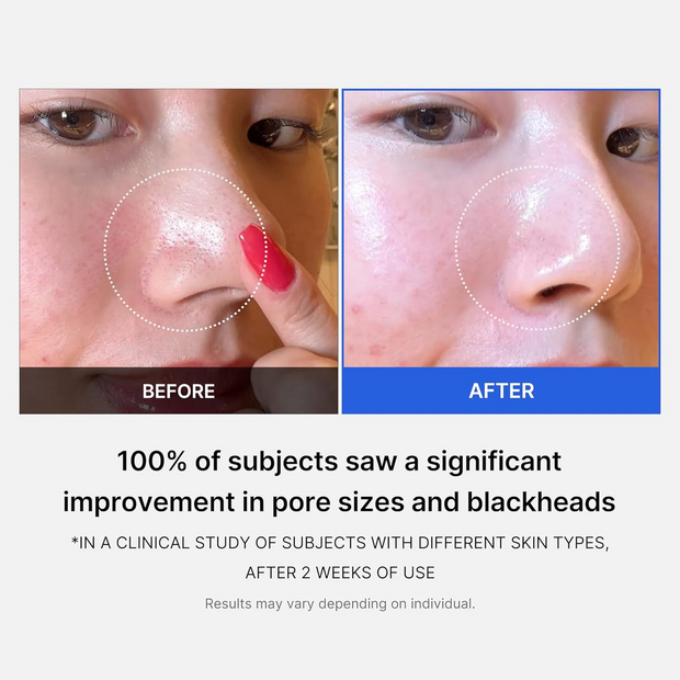 Zero Pore Pad